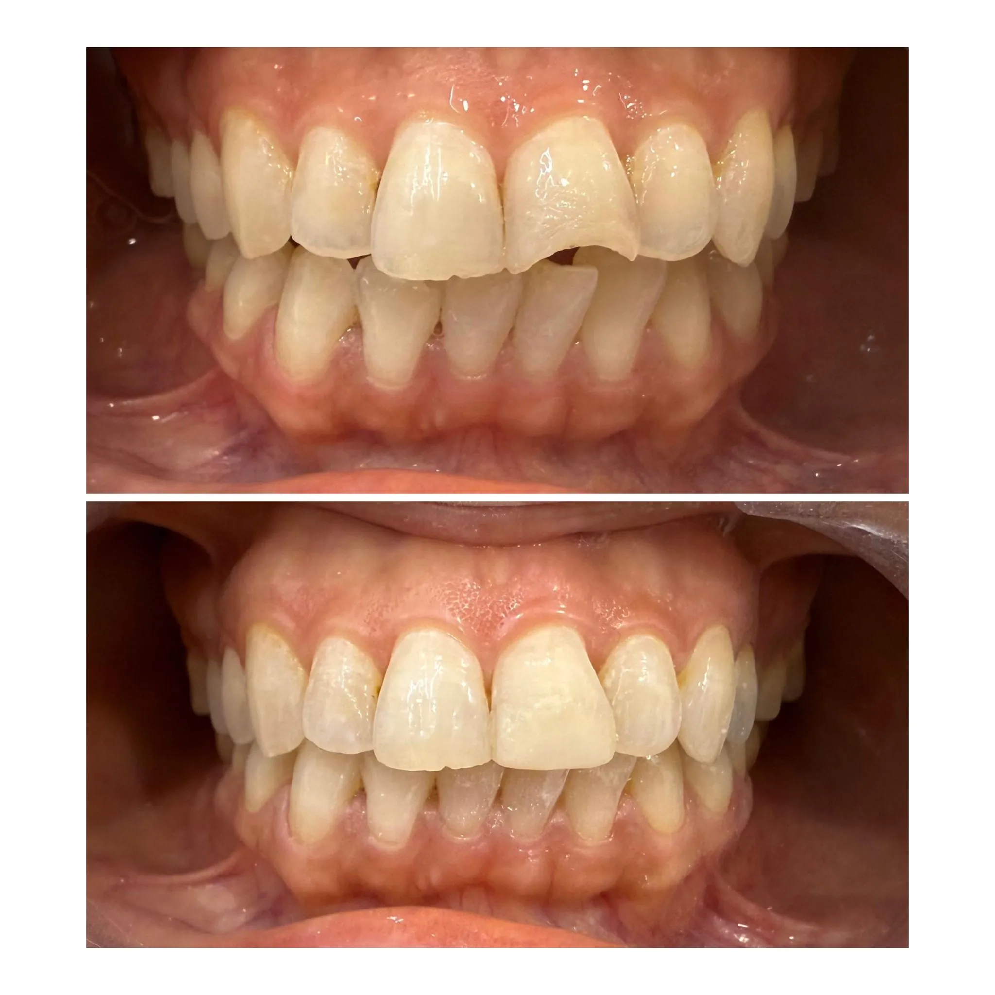 Dental Treatment Result 2