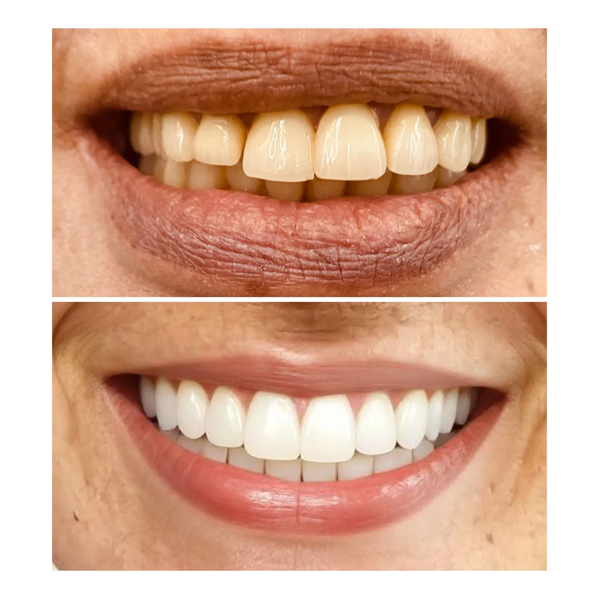 Dental Treatment Result 3