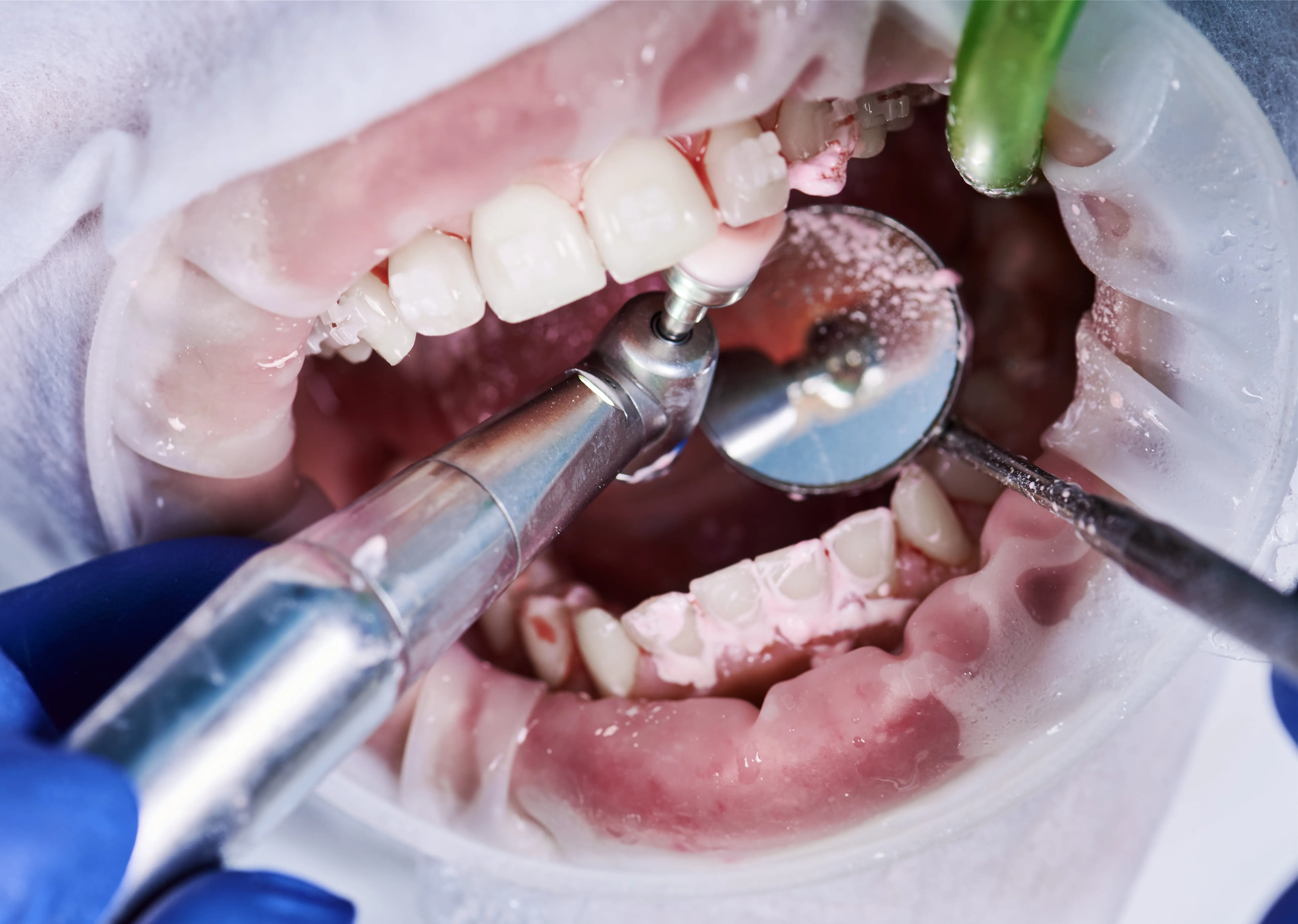 Periodontology (Gum Treatments)